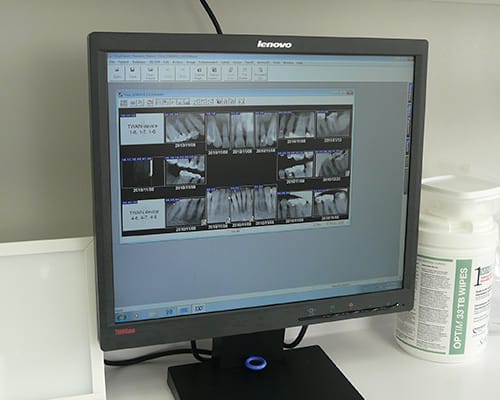 Dental Technology, Pointe Claire Dentist